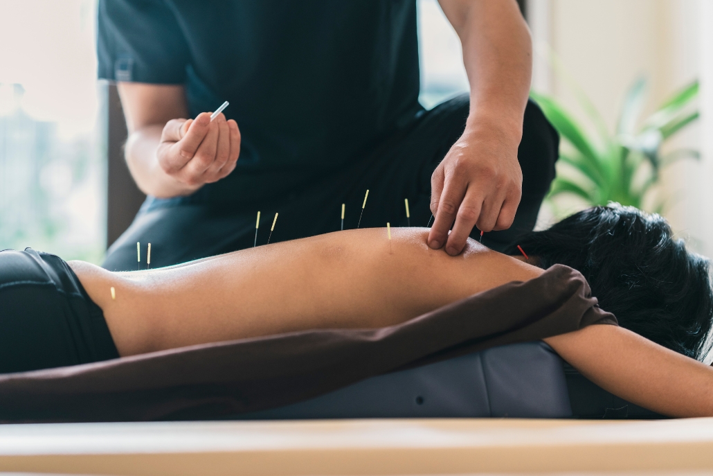 Acupuncture treatment targeting back pain at Aspen Elevated Health, acclaimed as Aspen's best spa.