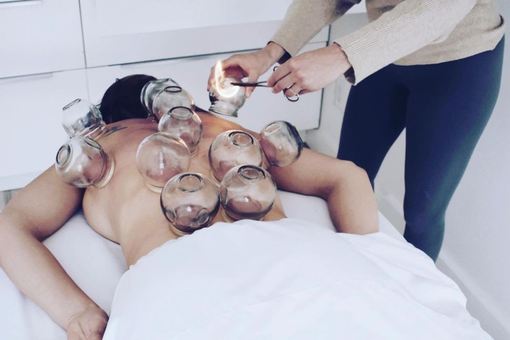 Cupping performed at Aspen Elevated Health